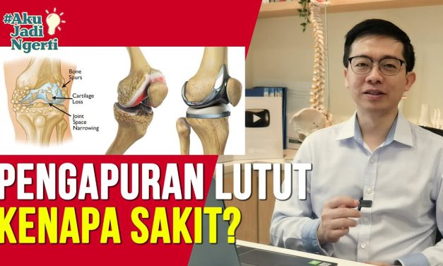 Kenali Gejala Pengapuran Lutut Yang Bisa Terjadi Pada Usia Muda