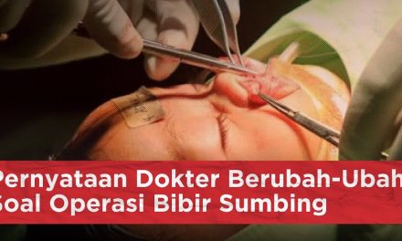 Operasi Rekonstruksi Sumbing Langkah Menuju Percaya Diri